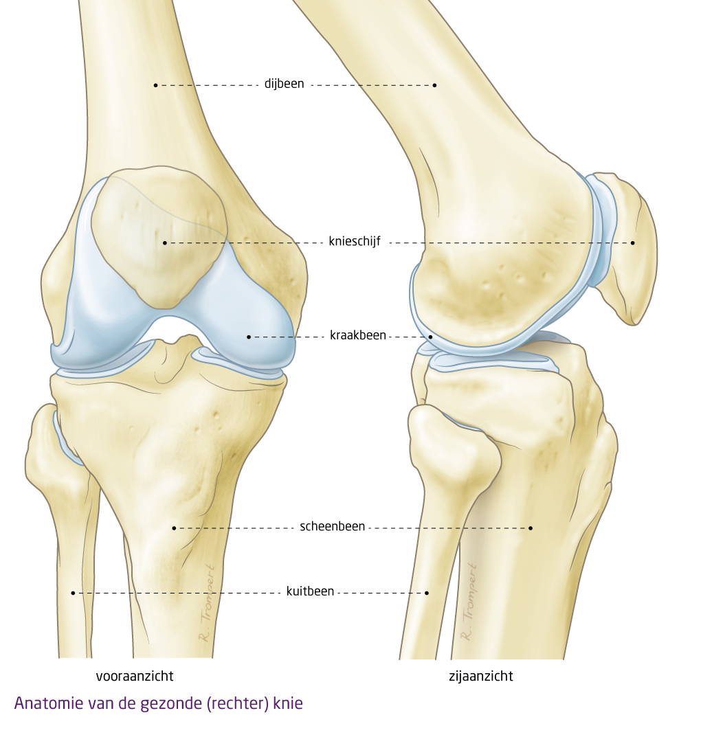 Thriller Dat Uil OCON - Aandoening: Knie artrose (knieprothese)